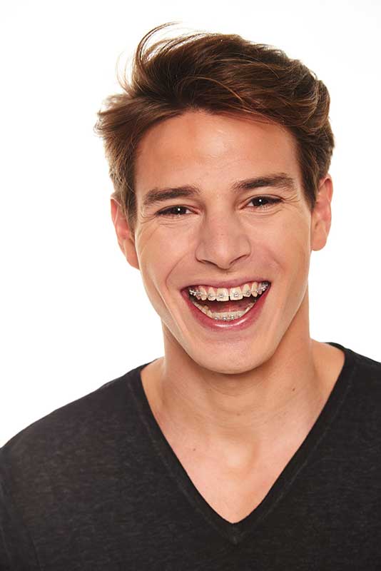 Brackets